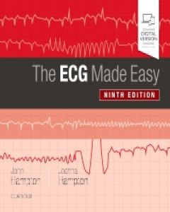 ecgs made easy pdf