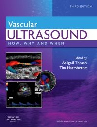 Vascular Ultrasound