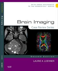 Brain Imaging: Case Review Series E-Book