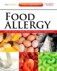 Food Allergy