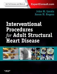 Interventional Procedures for Adult Structural Heart Disease