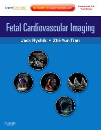 Fetal Cardiovascular Imaging: A Disease Based Approach