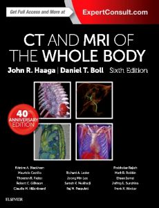 CT and MRI of the Whole Body