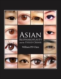 Asian Blepharoplasty and the Eyelid Crease E-Book