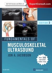 Fundamentals of Musculoskeletal Ultrasound