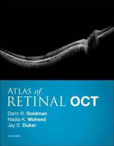 Atlas of Retinal OCT: Optical Coherence Tomography