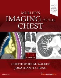 Muller's Imaging of the Chest