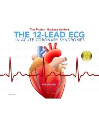 The 12-Lead ECG in Acute Coronary Syndromes