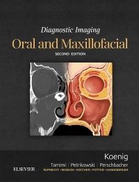 Diagnostic Imaging: Oral and Maxillofacial E-Book