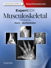 ExpertDDx: Musculoskeletal