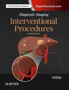 Diagnostic Imaging: Interventional Procedures