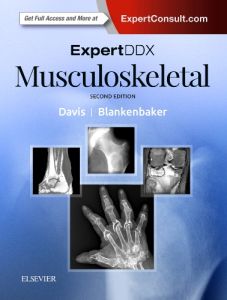 ExpertDDx: Musculoskeletal