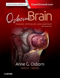 Osborn's Brain E-Book