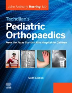 Tachdjian's Pediatric Orthopaedics: From the Texas Scottish Rite Hospital for Children