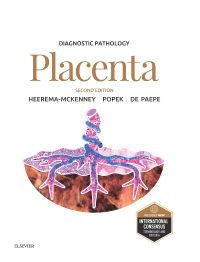 Diagnostic Pathology: Placenta E-Book