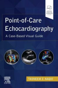 Point-of-Care Echocardiography