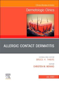 Allergic Contact Dermatitis,An Issue of Dermatologic Clinics - E-Book