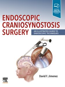 Endoscopic Craniosynostosis Surgery