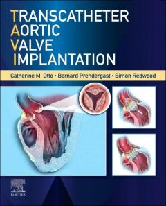 Transcatheter Aortic Valve Implantation