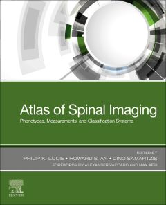 Atlas of Spinal Imaging