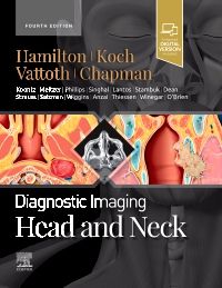 Diagnostic Imaging: Head and Neck