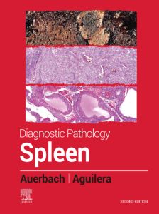 Diagnostic Pathology: Spleen