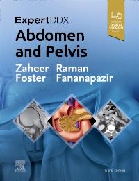 ExpertDDx: Abdomen and Pelvis