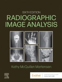 Radiographic Image Analysis - E-Book