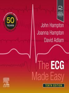 The ECG Made Easy