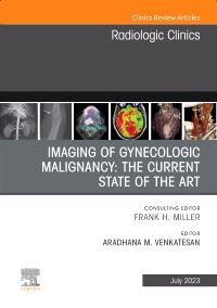 Imaging of Gynecologic Malignancy: The Current State of the Art, An Issue of Radiologic Clinics of North America