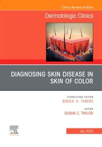 Diagnosing Skin Disease in Skin of Color, An Issue of Dermatologic Clinics