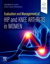 Evaluation and Management of Hip and Knee Arthritis in Women