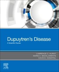 Dupuytren's Disease