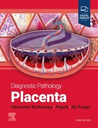 Diagnostic Pathology: Placenta