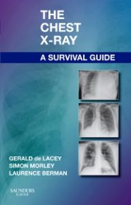 The Chest X-Ray: A Survival Guide