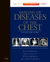 Imaging of Diseases of the Chest