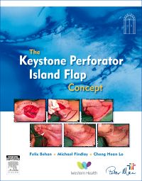 The Keystone Perforator Island Flap Concept - E-Book