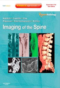 Imaging of the Spine E-Book