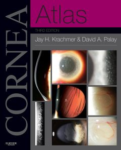 Cornea Atlas E-Book