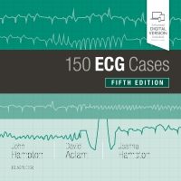 150 ECG Cases - 9780702074585 | Elsevier Health