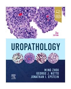 Uropathology