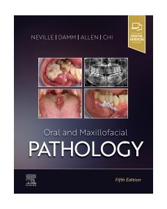 Oral and Maxillofacial Pathology