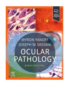 Ocular Pathology