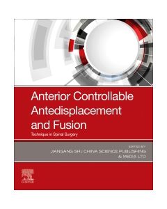 Anterior Controllable Antedisplacement and Fusion