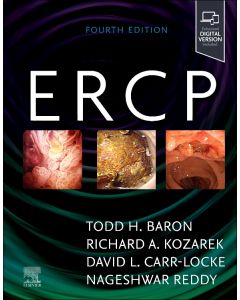 ERCP