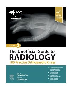 The Unofficial Guide to Radiology: 100 Practice Orthopaedic X-rays