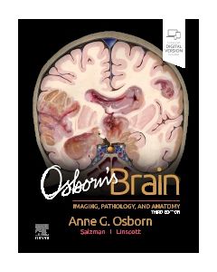 Osborn's Brain