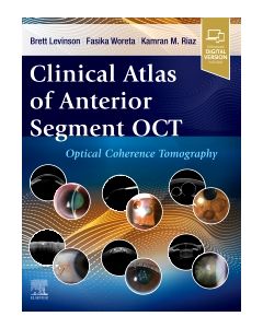 Clinical Atlas of Anterior Segment OCT: Optical Coherence Tomography